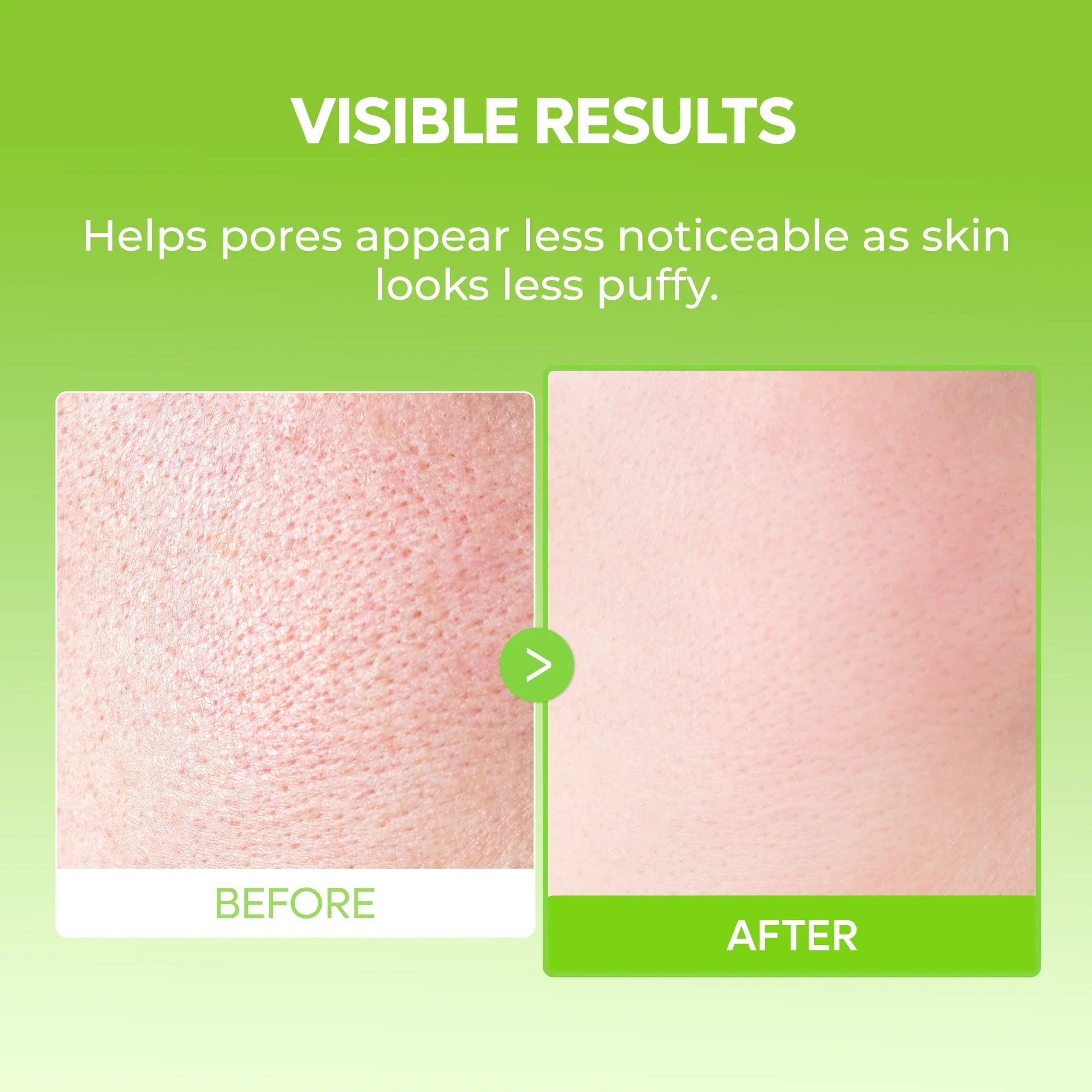 CACTOX DE-PUFFING PORE TOX MASK SET